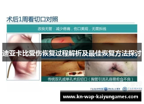 迪亚卡比受伤恢复过程解析及最佳恢复方法探讨